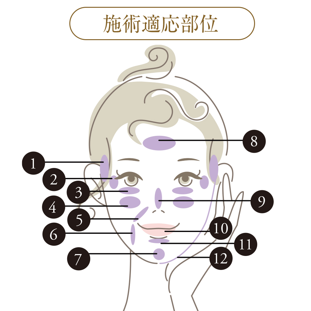 ヒアルロン酸 施術適応部位