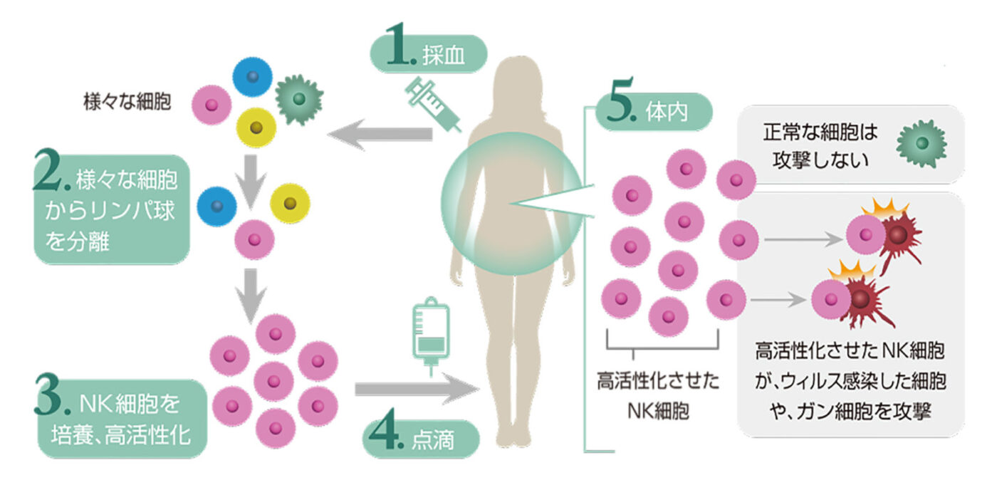 NK細胞療法_説明画像