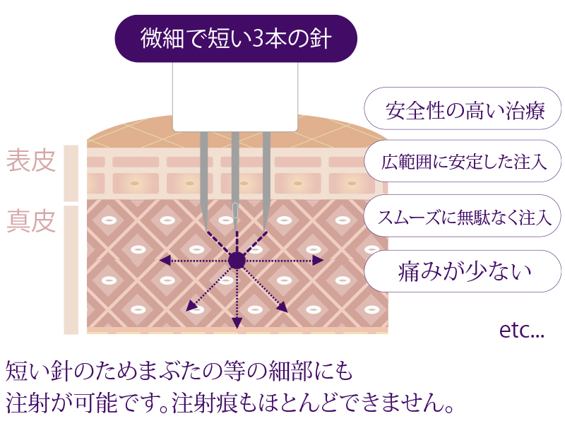 低侵襲マイクロ注射針イメージ