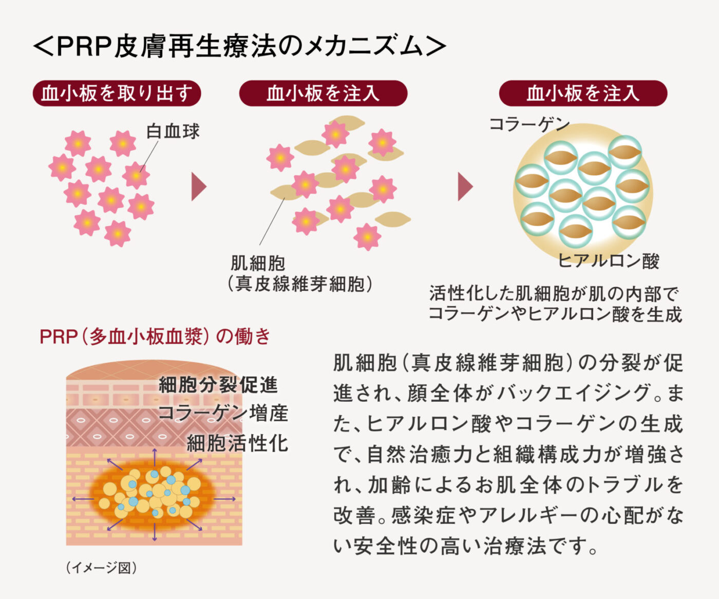 PRPメカニズム