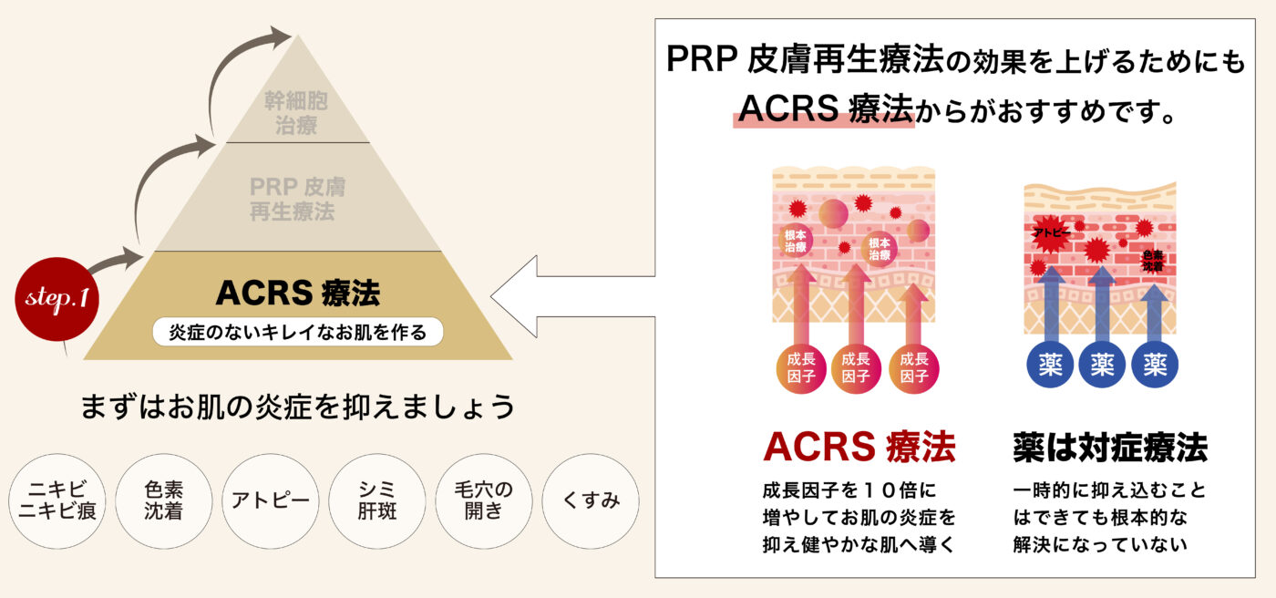 ACRS図hp