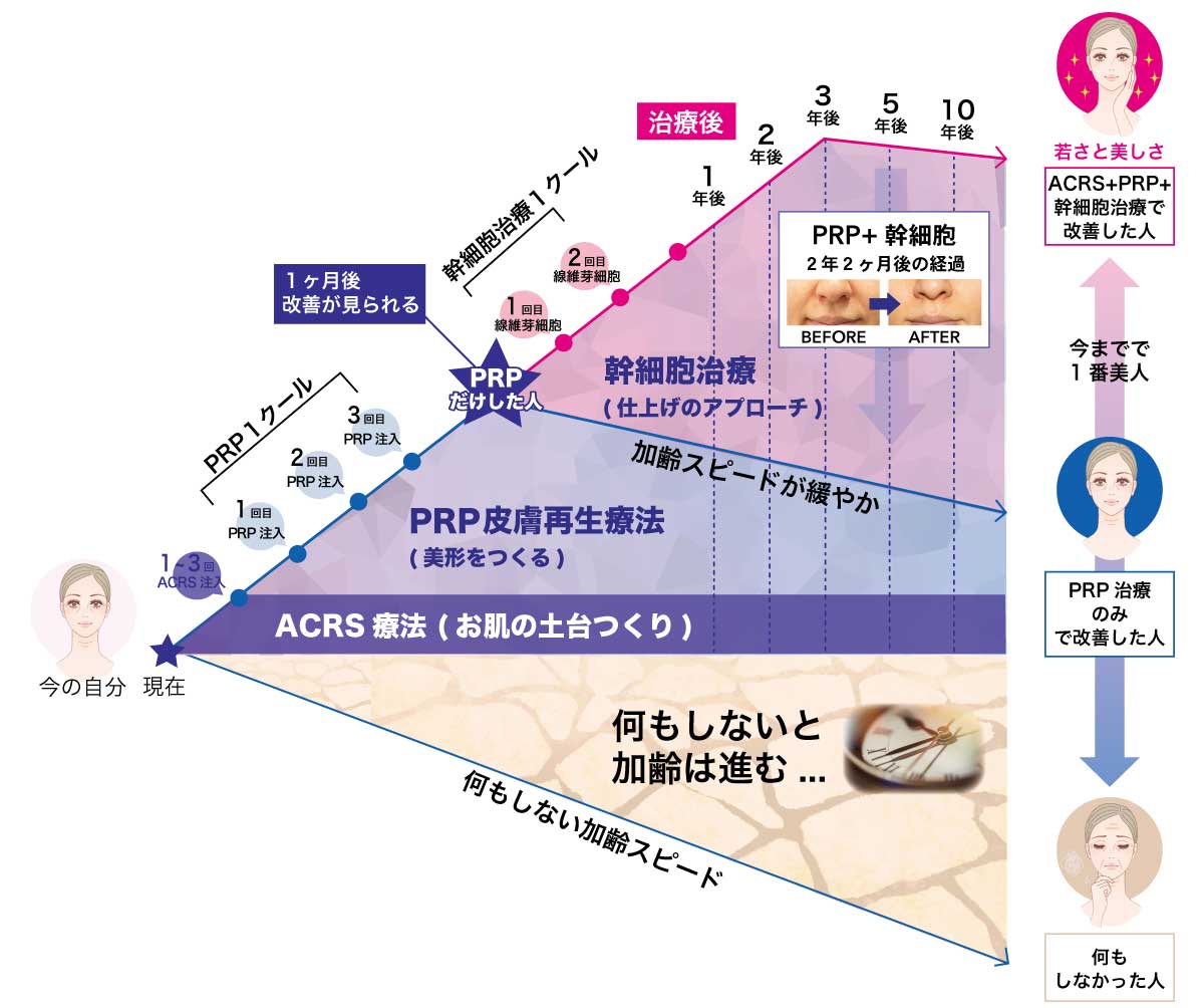 new幹細胞ピラミッド