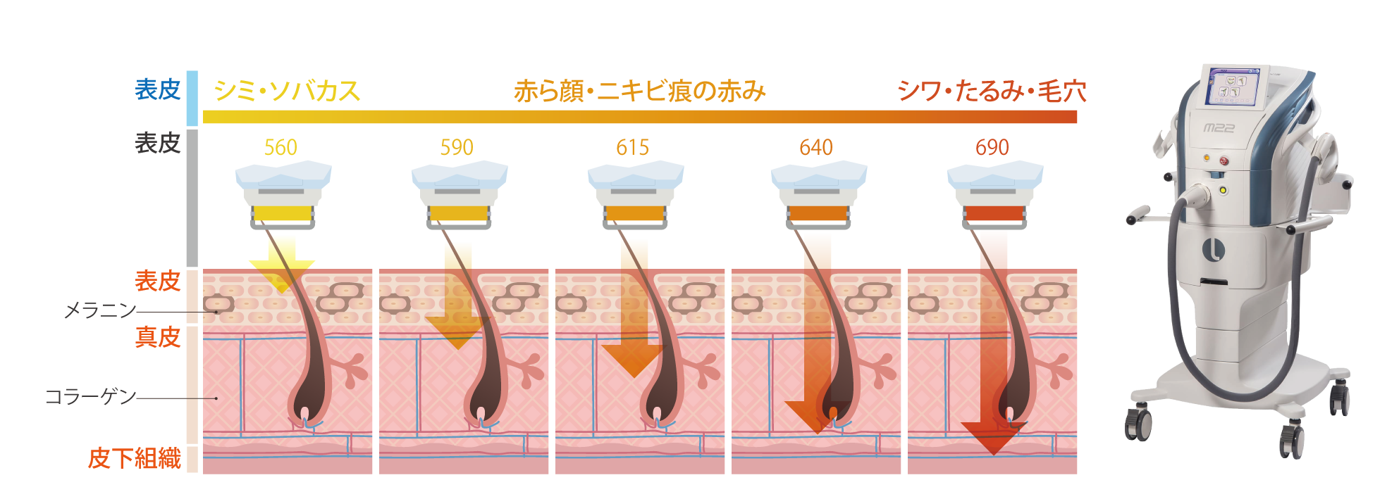 フォトフェイシャルM22のお悩み別照射