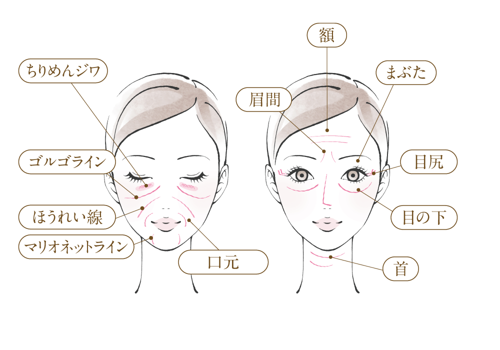 シワ治療・シワ改善、シワの部位説明イラストsp用