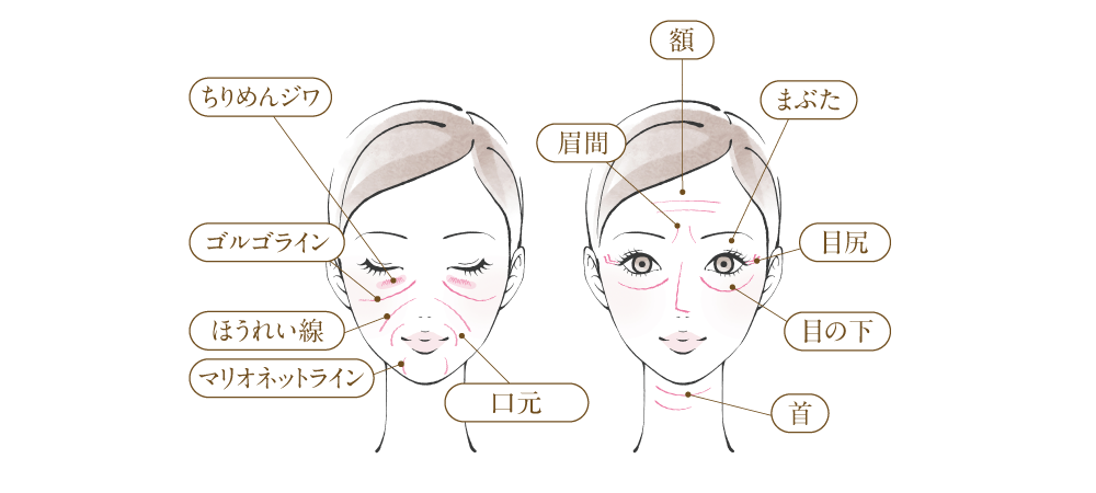 シワ治療・シワ改善、シワの部位説明イラストpc用