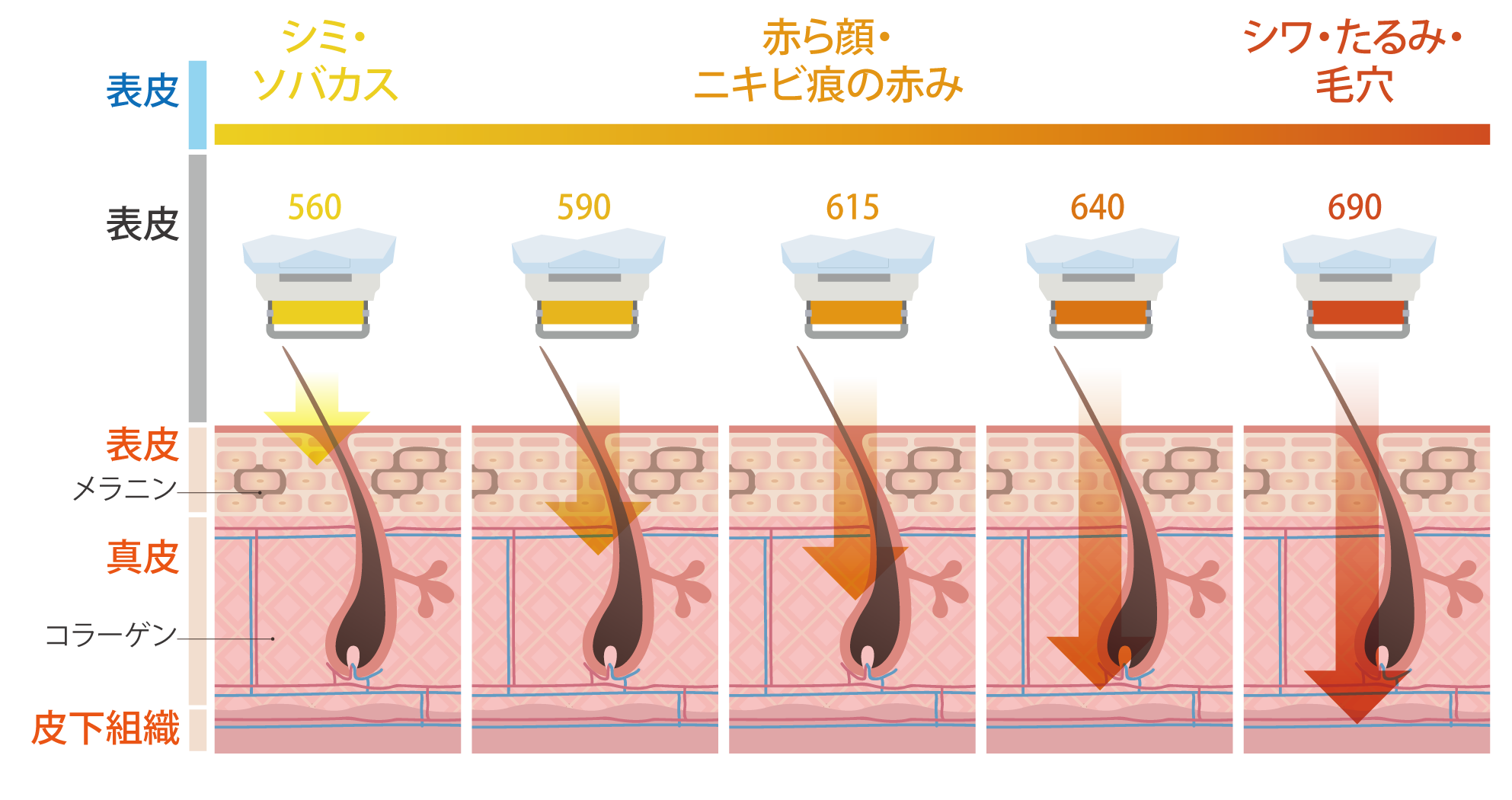 フォトフェイシャルM22のお悩み別照射