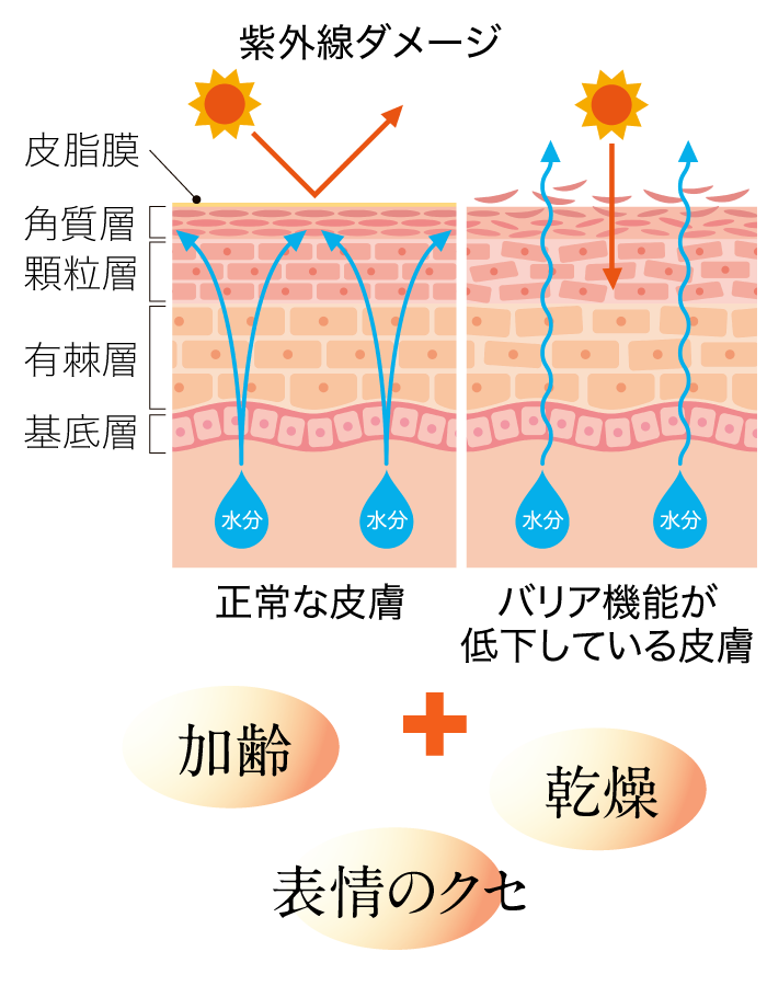 シワのできる原因