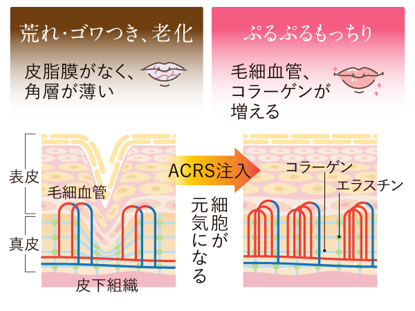 唇の肌再生図