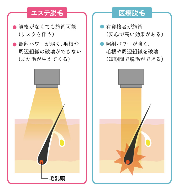 エステ脱毛と医療脱毛の違い