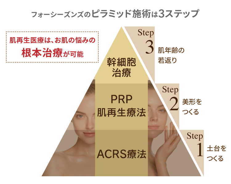 ピラミッド施術　根本治療