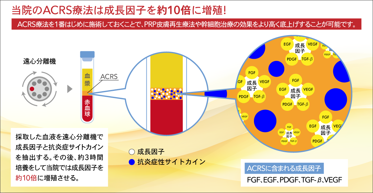 成長因子　10倍　ACRS